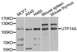 Western blot analysis of extract of various cells using UTP14A antibody