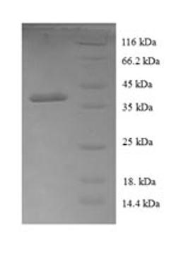 (Tris-Glycine gel) Discontinuous SDS-PAGE (reduced) with 5% enrichment gel and 15% separation gel.