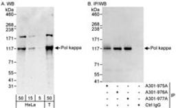 Detection of human Pol kappa by western blot and immunoprecipitation.