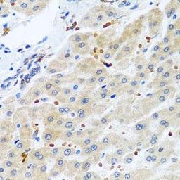 Immunohistochemical staining of human liver tissue using RGS5 antibody (dilution of 1:100)