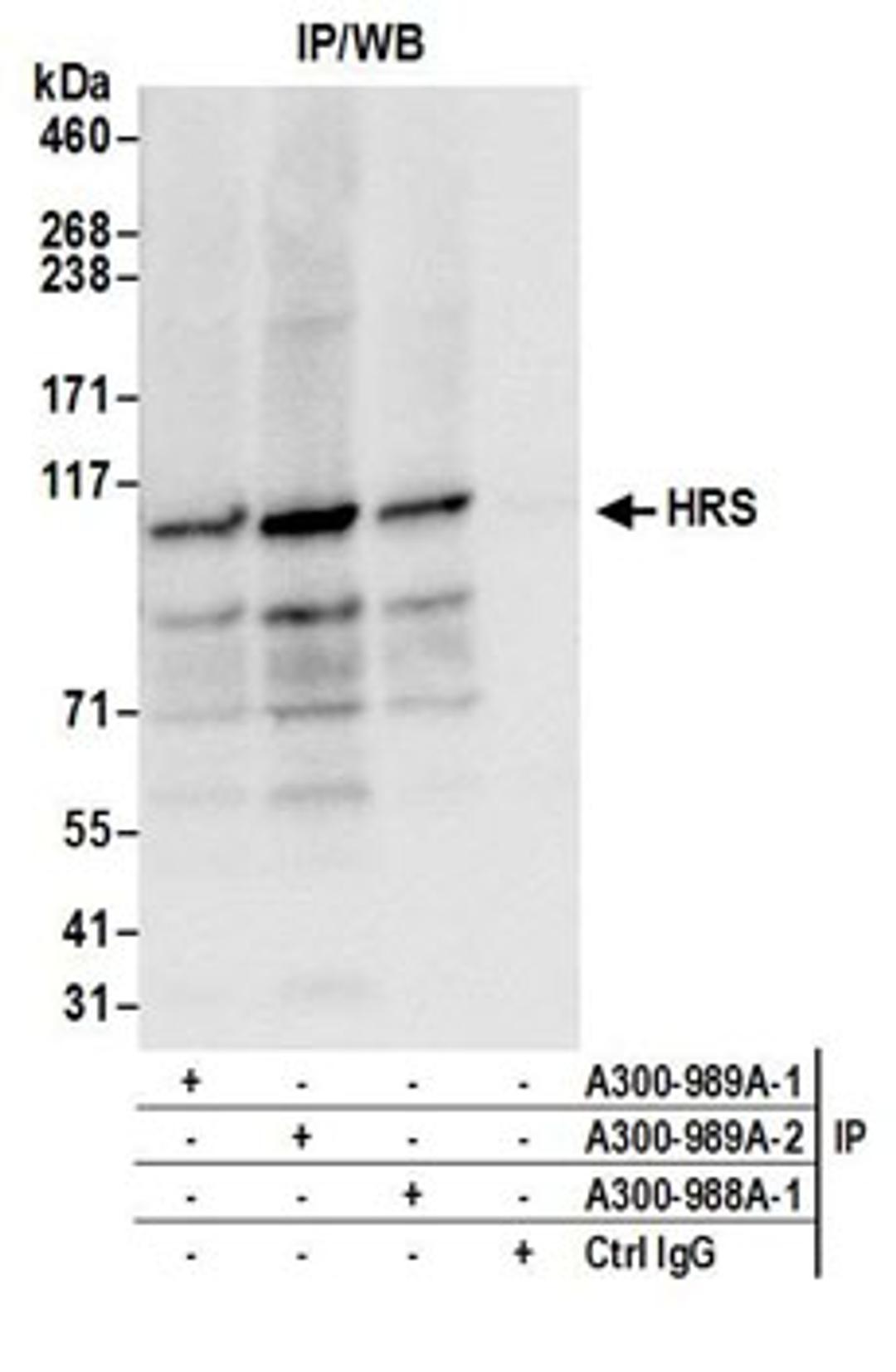 Detection of human HRS by western blot of immunoprecipitates.