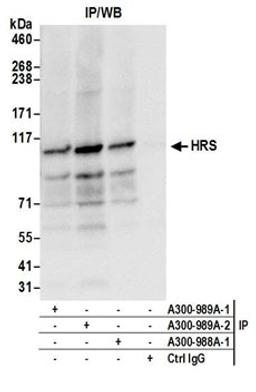 Detection of human HRS by western blot of immunoprecipitates.