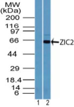 Western Blot: Zic2 Antibody [NBP2-24607] - Analysis of ZIC2 in HepG2 cell lysate using 1) pre-bleed, and 2) this antibody.  Goat anti-rabbit Ig HRP secondary antibody and PicoTect ECL substrate solution were used for this test.