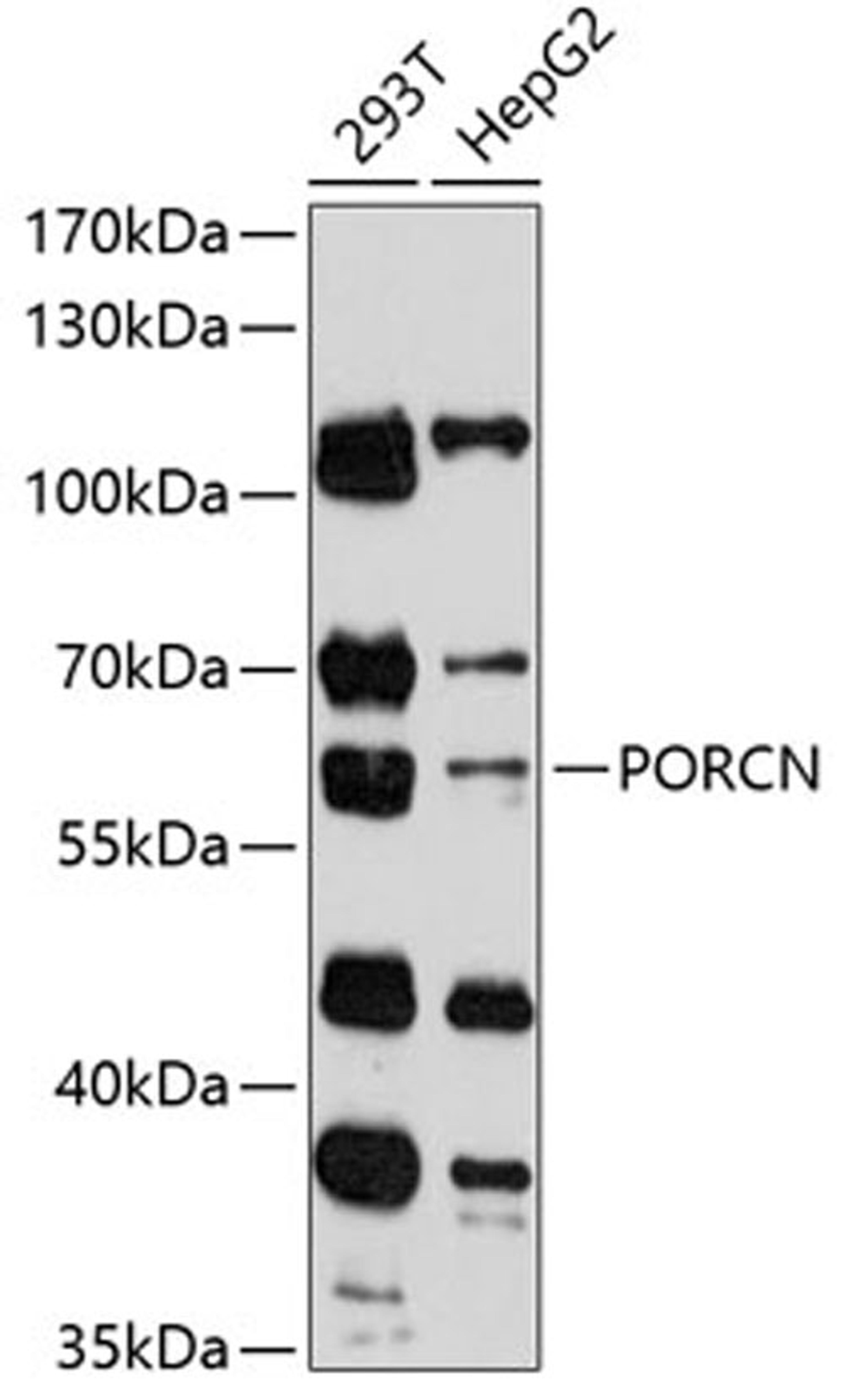 Western blot - PORCN antibody (A12120)