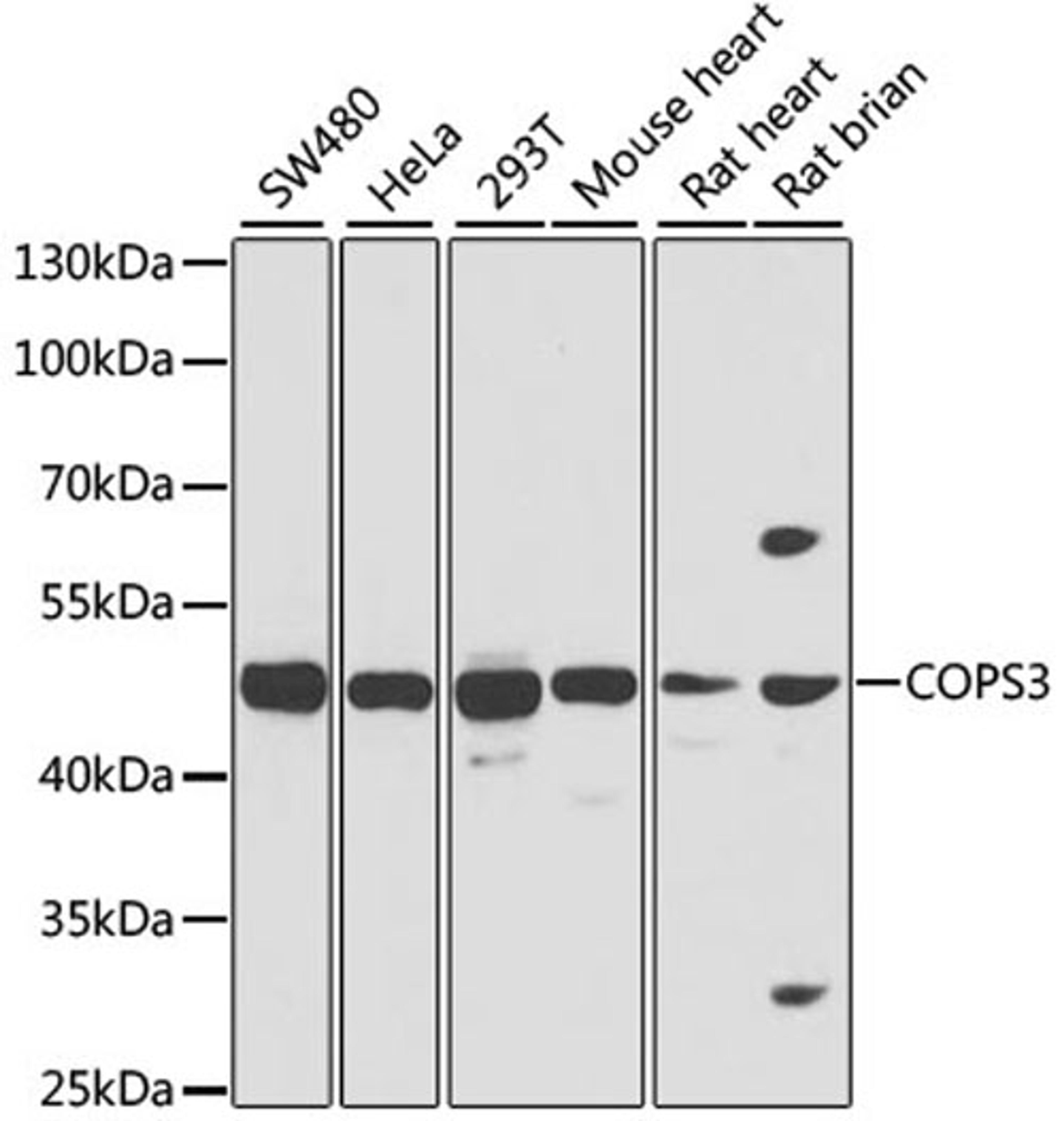 Western blot - COPS3 antibody (A7017)