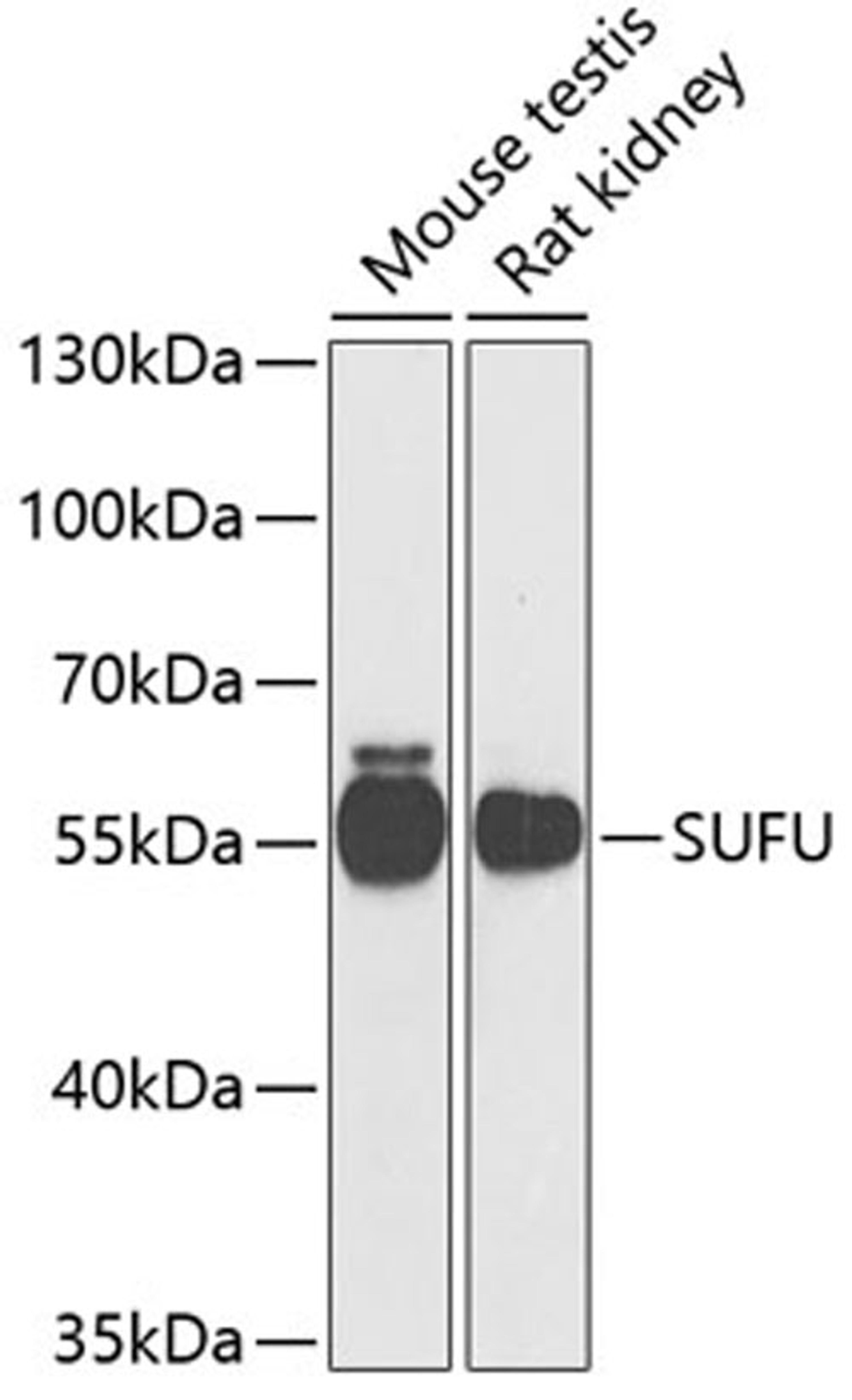 Western blot - SUFU antibody (A6757)