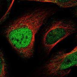 Immunocytochemistry/Immunofluorescence: GTF2IRD1 Antibody [NBP1-91973] - Staining of human cell line U-2 OS shows positivity in nucleus but not nucleoli & cytoplasm.