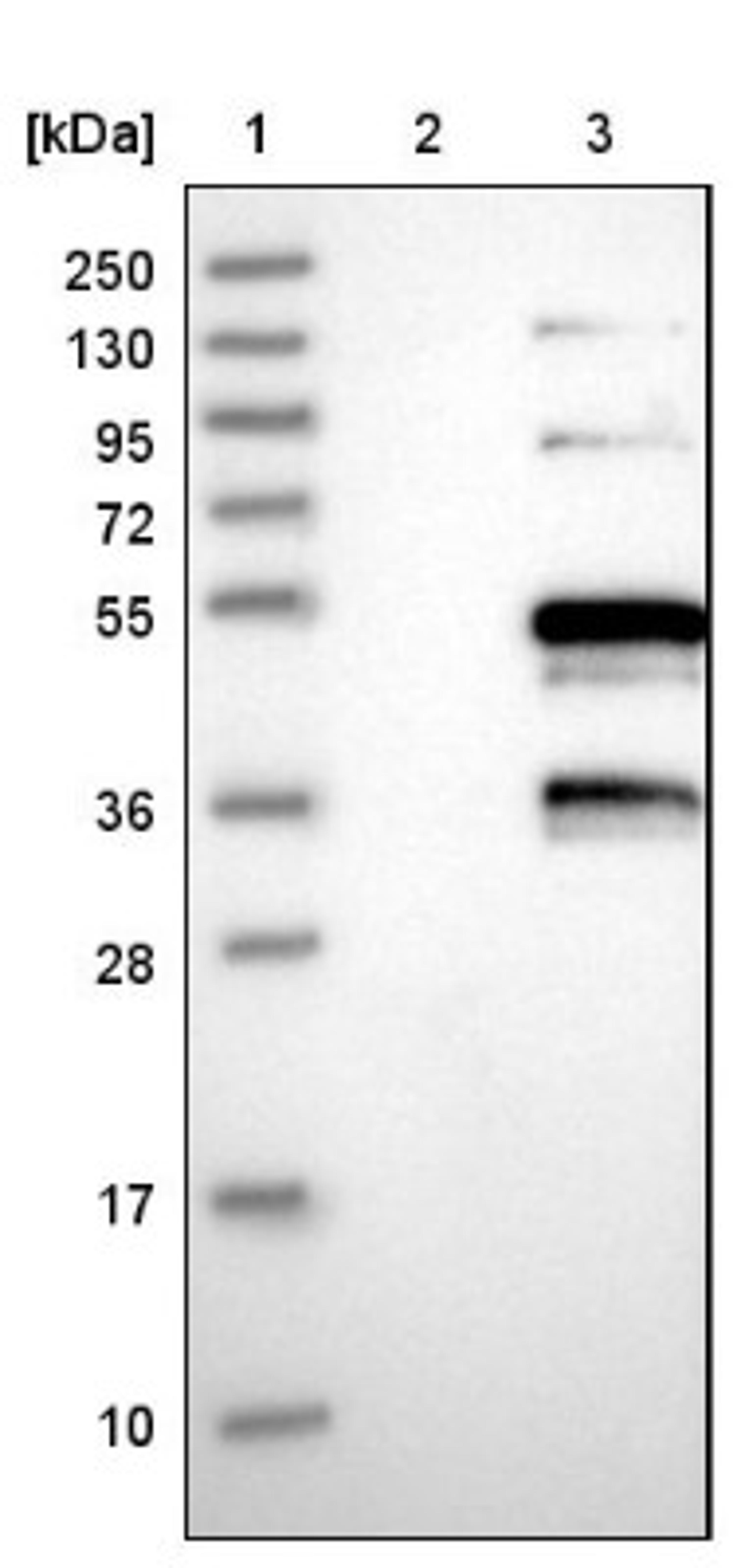 Western Blot: SNRNP48 Antibody [NBP1-86760] - Lane 1: Marker [kDa] 250, 130, 95, 72, 55, 36, 28, 17, 10<br/>Lane 2: Negative control (vector only transfected HEK293T lysate)<br/>Lane 3: Over-expression lysate (Co-expressed with a C-terminal myc-DDK tag (~3.1 kDa) in mammalian HEK293T cells, LY407462)