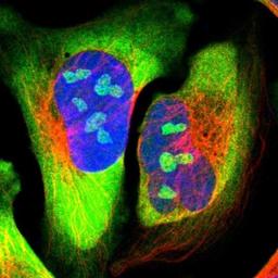 Immunofluorescence: CCT5 Antibody [NBP1-83042] - Staining of human cell line U-2 OS shows positivity in nucleoli & cytoplasm.