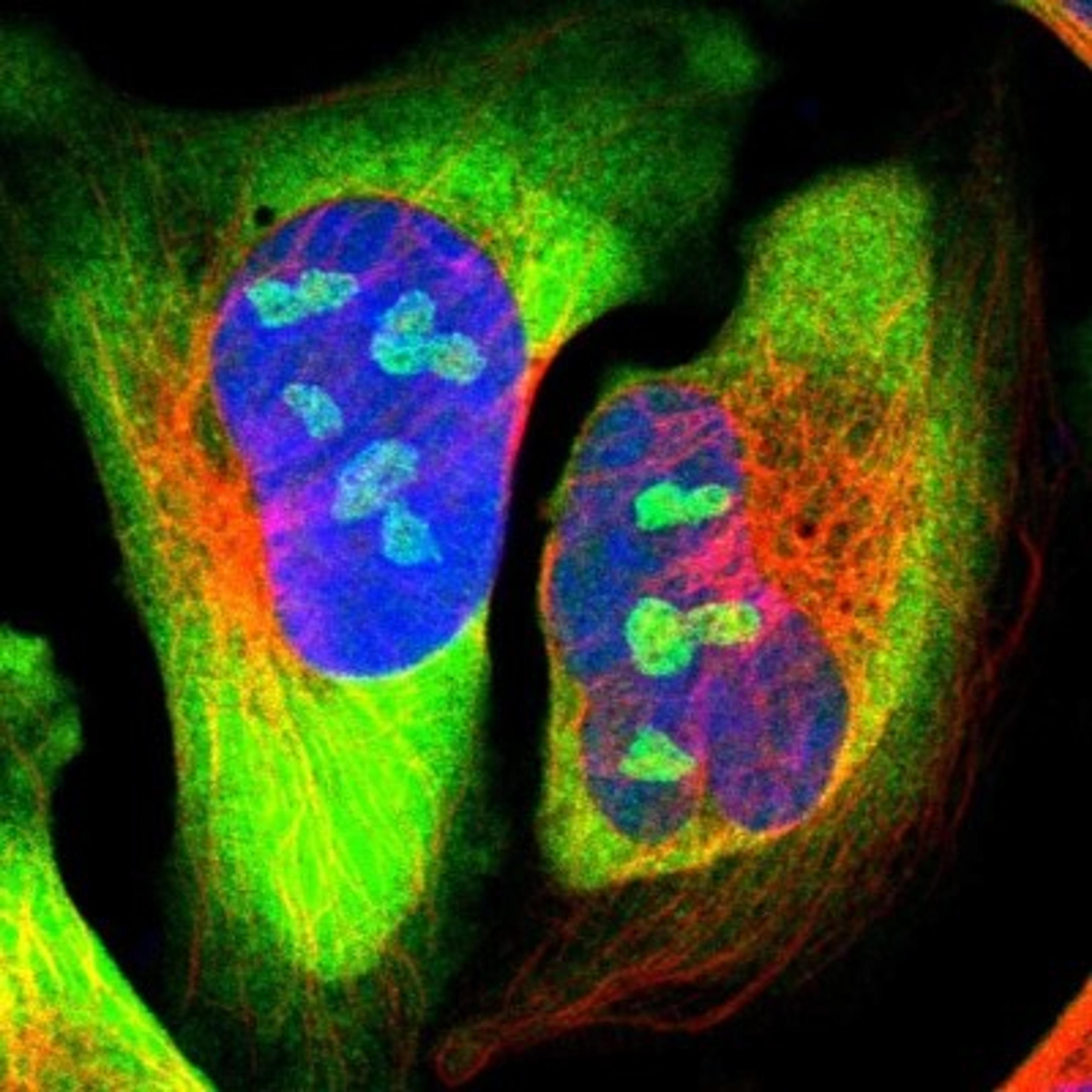 Immunofluorescence: CCT5 Antibody [NBP1-83042] - Staining of human cell line U-2 OS shows positivity in nucleoli & cytoplasm.