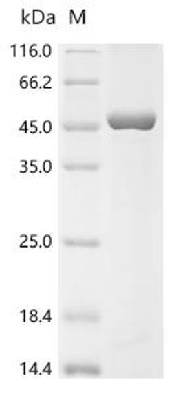 (Tris-Glycine gel) Discontinuous SDS-PAGE (reduced) with 5% enrichment gel and 15% separation gel.