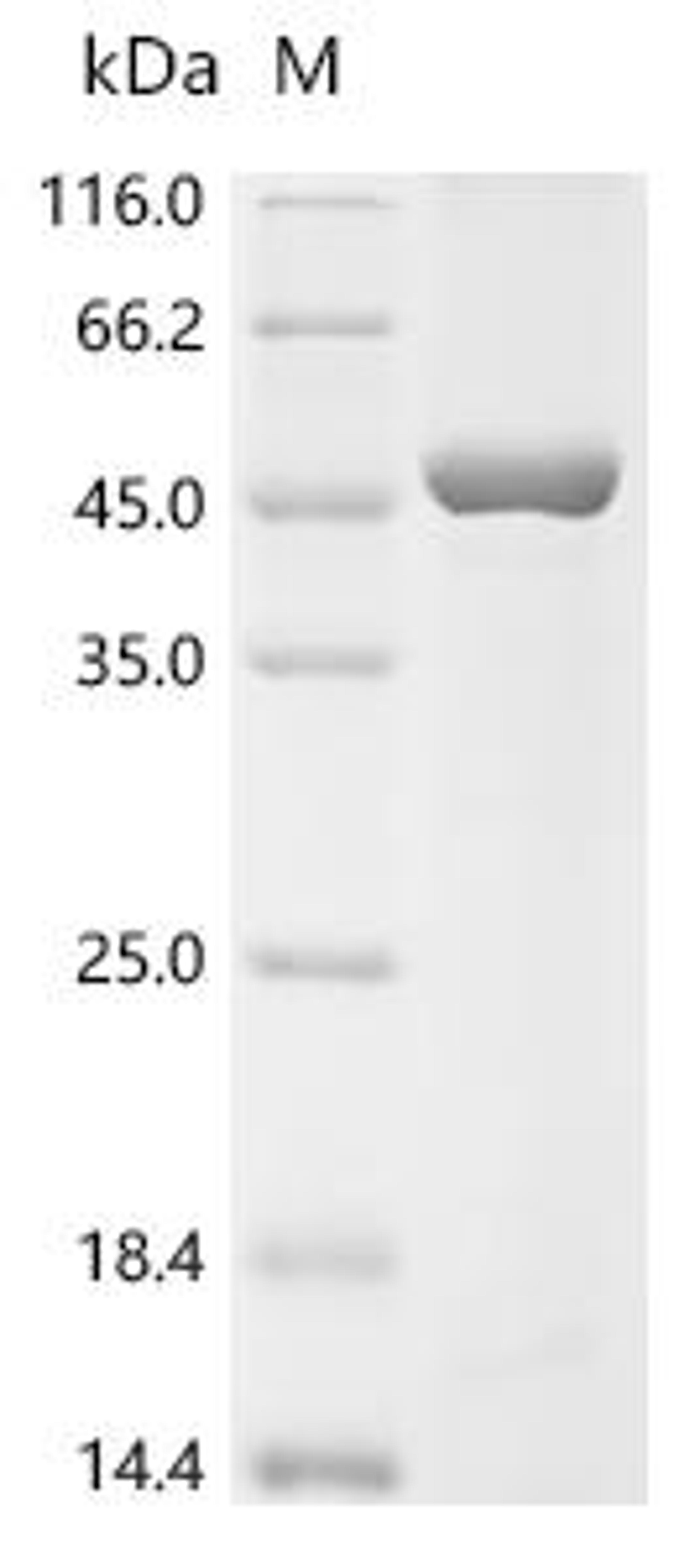 (Tris-Glycine gel) Discontinuous SDS-PAGE (reduced) with 5% enrichment gel and 15% separation gel.