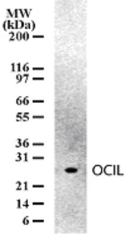 Western Blot: CLEC2D Antibody (166C1309) [NB100-56553] - Analysis of OCIL in mouse spleen cell lysates. Thirty microgram of cell lysates per lane of mini gel was analyzed in Western blotting using this antibody.