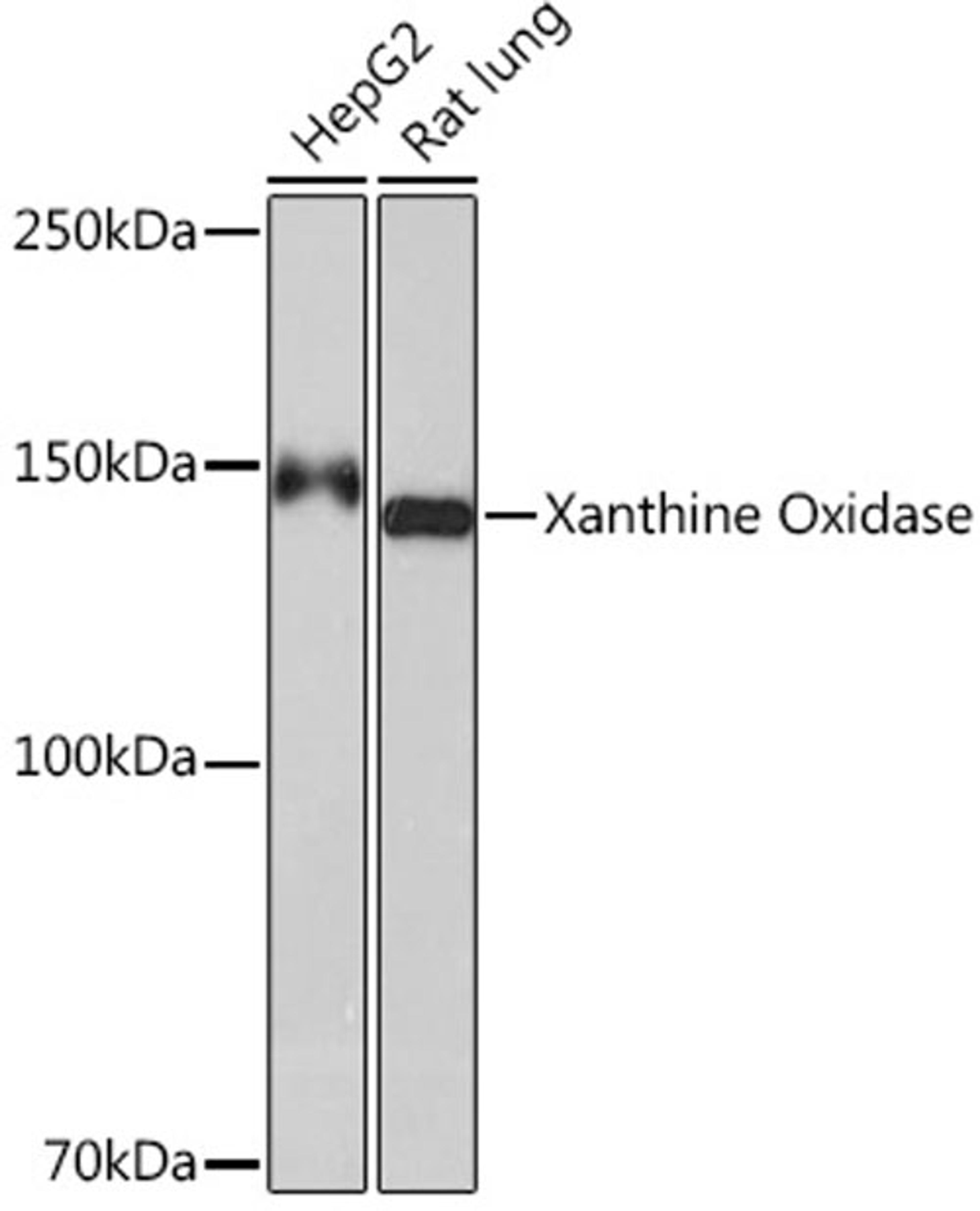 Western blot - Xanthine Oxidase Rabbit mAb (A9022)