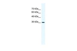 Antibody used in WB on Human HepG2 at 2.5 ug/ml.