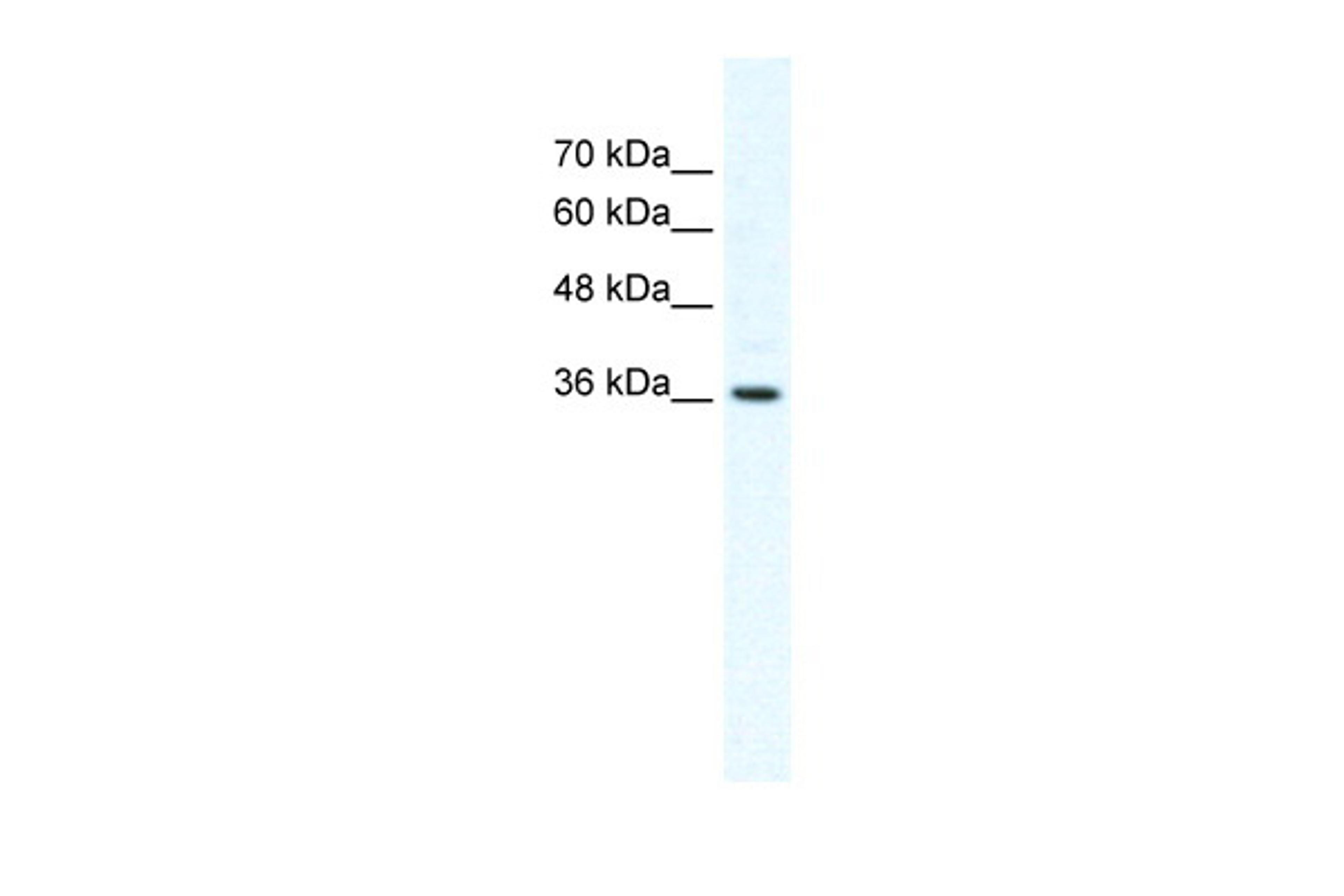 Antibody used in WB on Human HepG2 at 2.5 ug/ml.