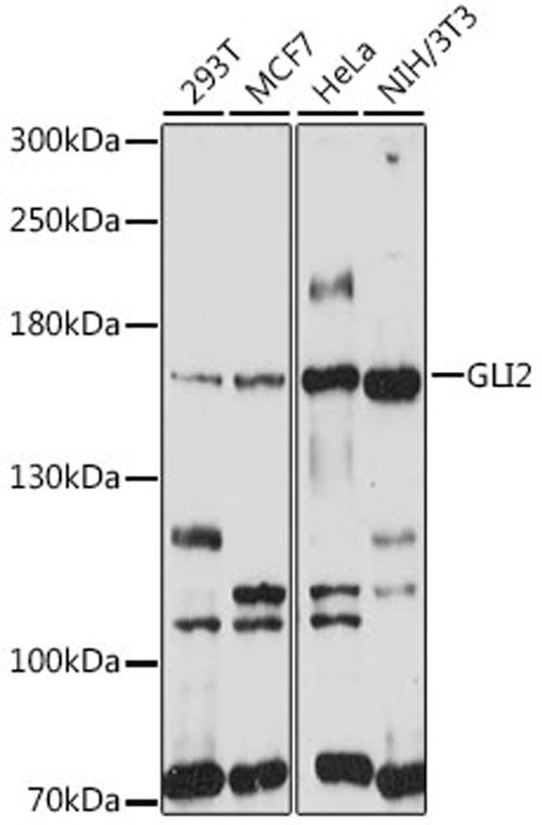 Western blot - GLI2 antibody (A16864)