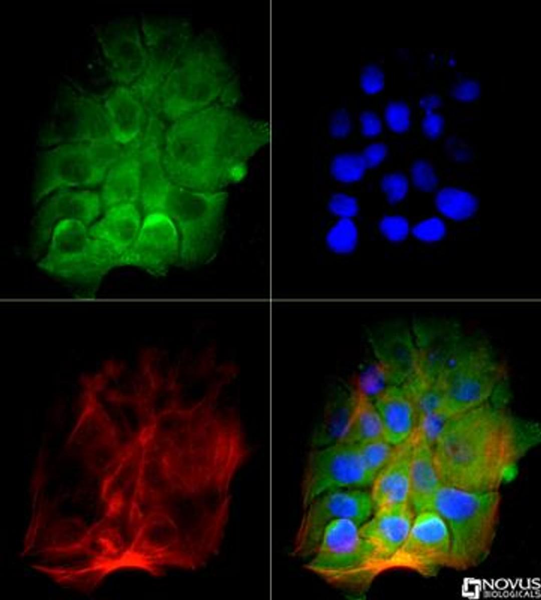 Immunocytochemistry/Immunofluorescence: BTK Antibody (7F12H4) [NB110-87047] - The BTK antibody was tested in A431 cells against DyLight 488 (Green). Actin and nuclei were counterstained for Phalloidin (Red) and DAPI (Blue), respectively.