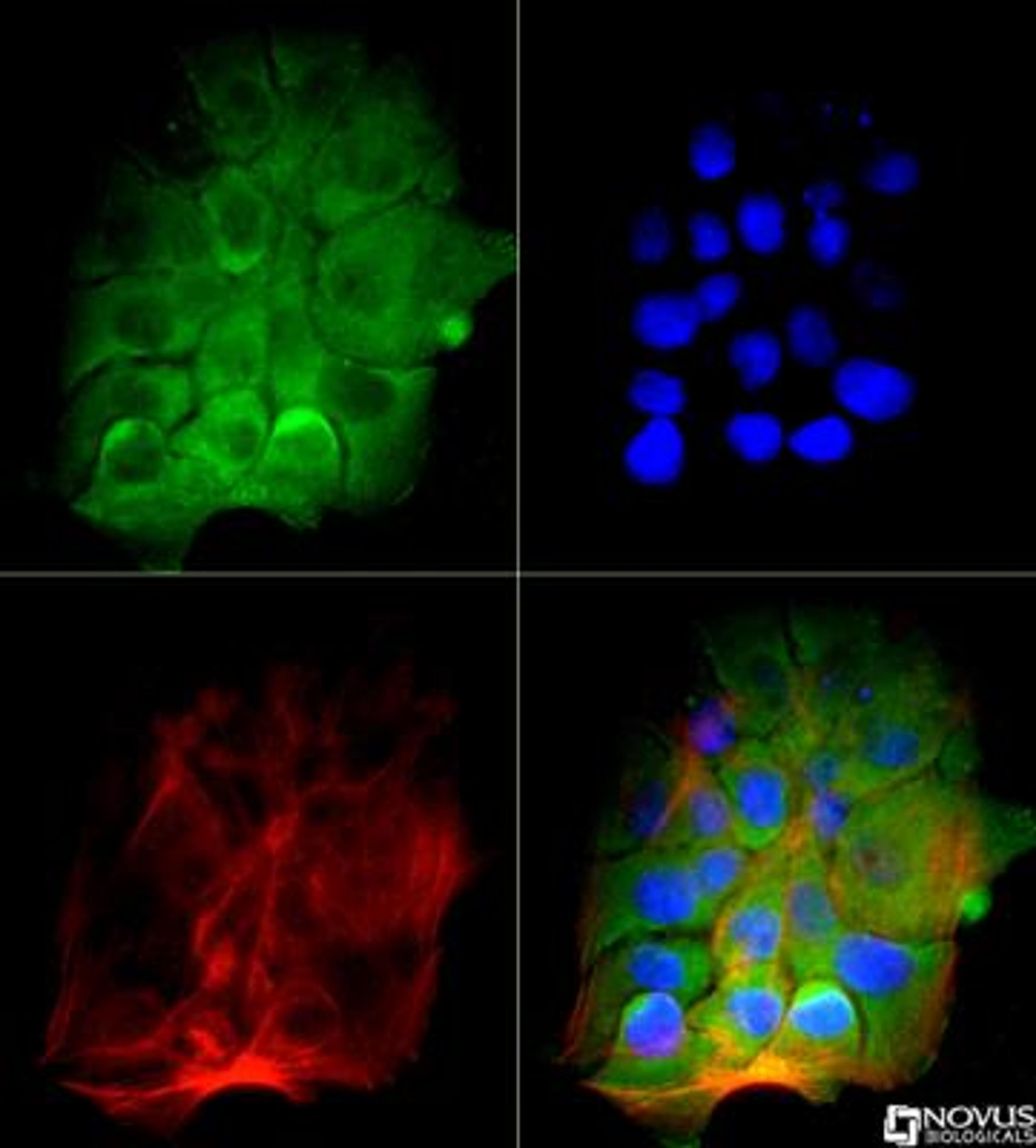 Immunocytochemistry/Immunofluorescence: BTK Antibody (7F12H4) [NB110-87047] - The BTK antibody was tested in A431 cells against DyLight 488 (Green). Actin and nuclei were counterstained for Phalloidin (Red) and DAPI (Blue), respectively.