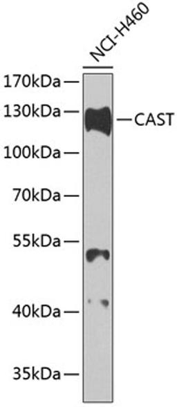 Western blot - CAST antibody (A0097)