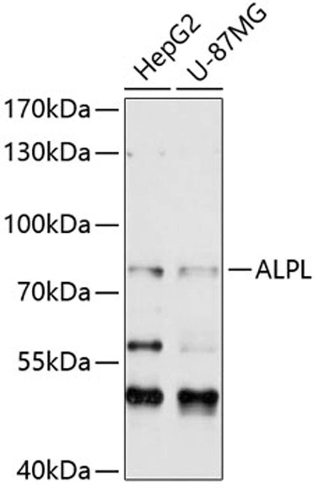 Western blot - ALPL antibody (A12396)