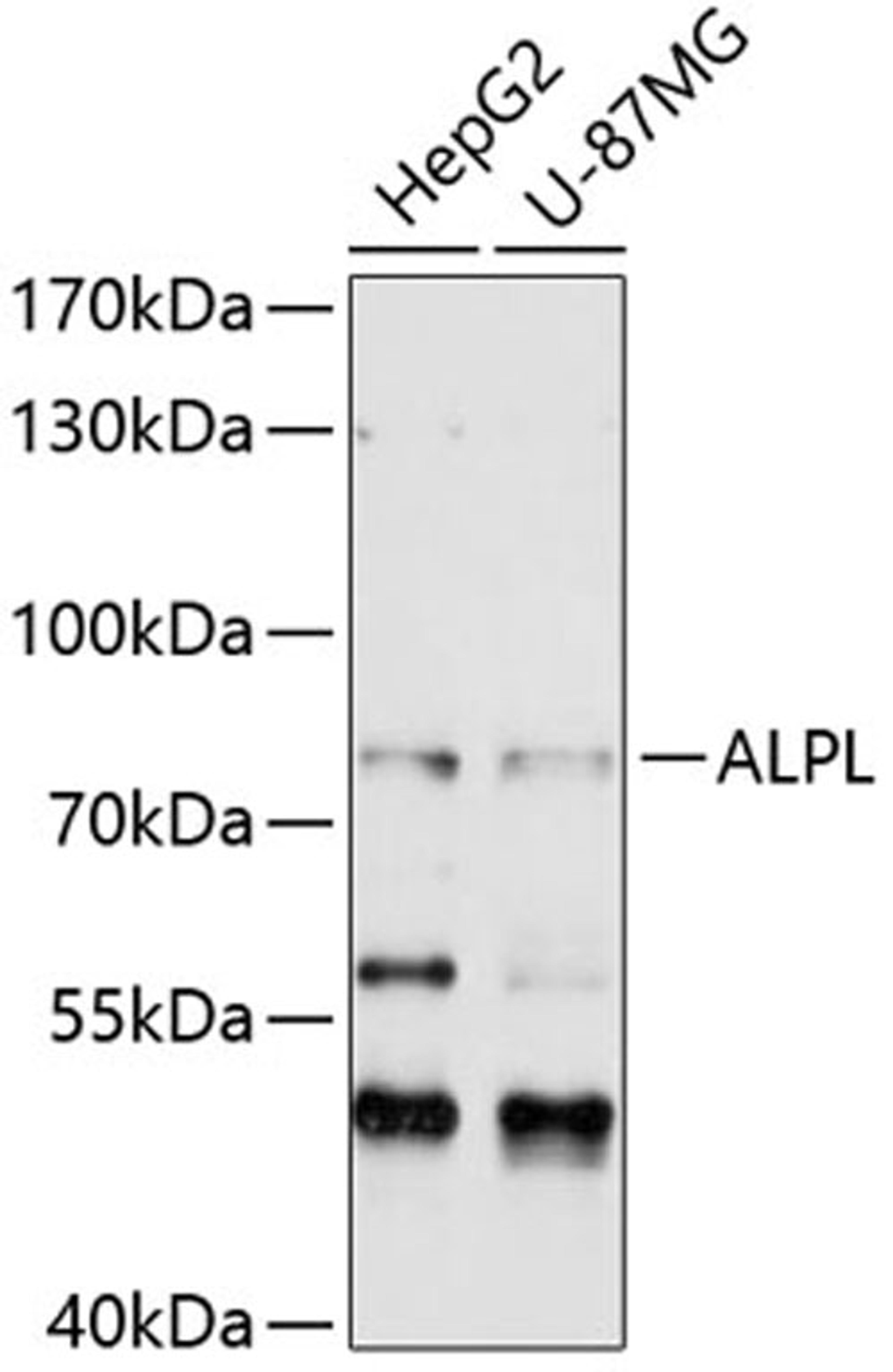 Western blot - ALPL antibody (A12396)