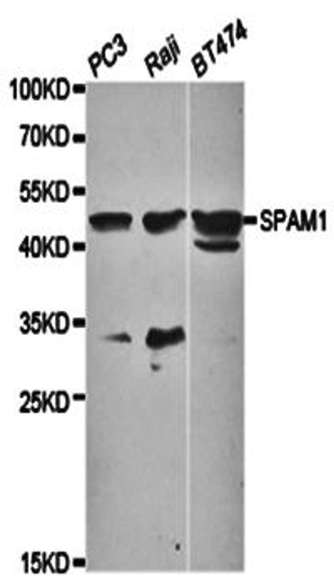 Western blot analysis of extracts of various cell lines lysates using SPAM1 antibody