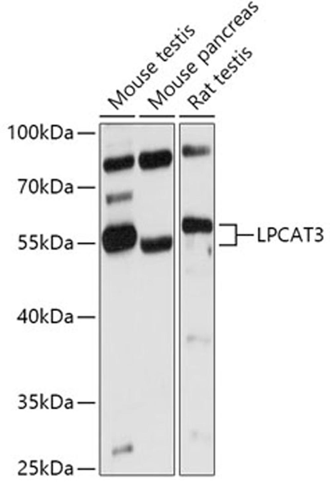 Western blot - LPCAT3 antibody (A17604)