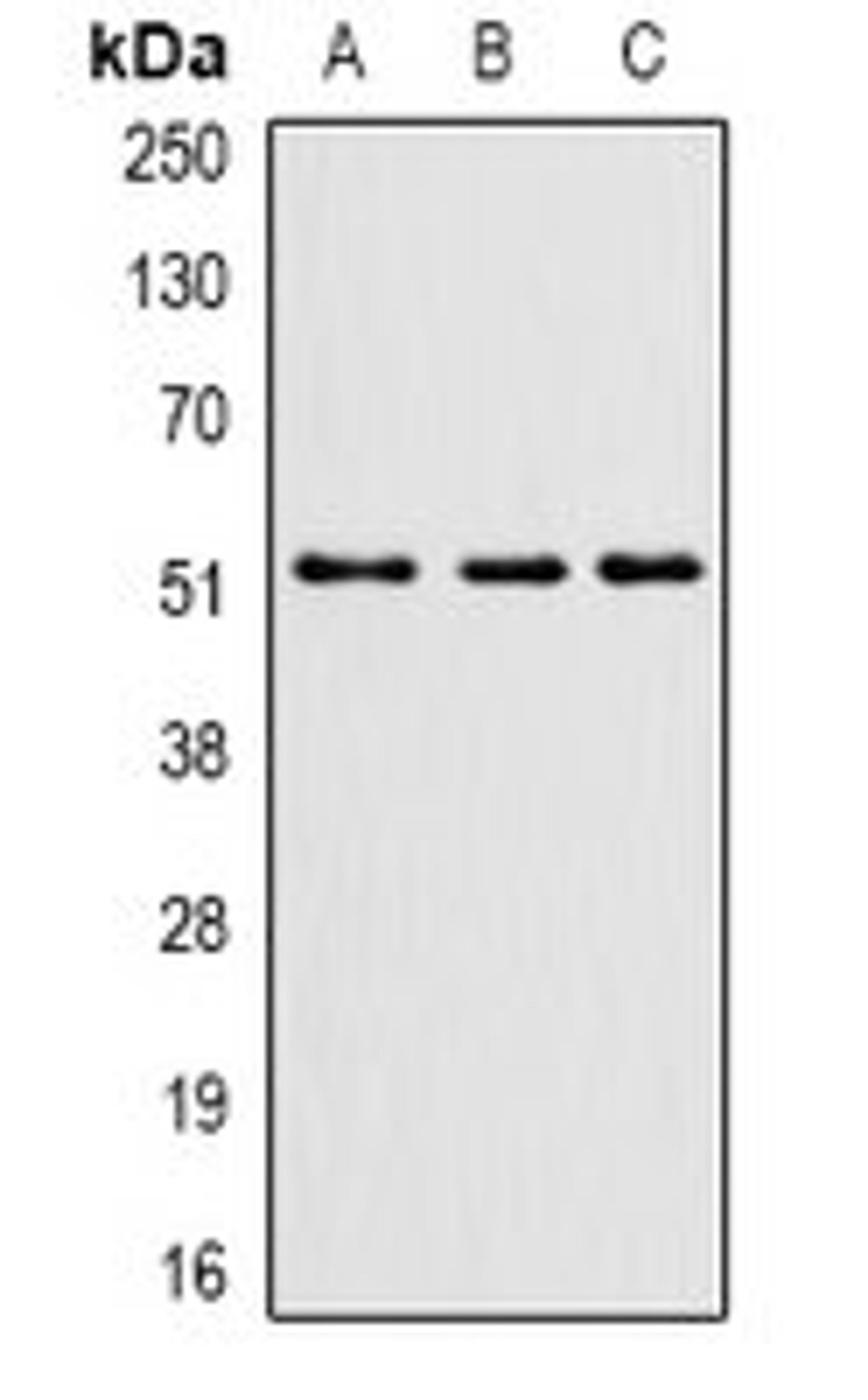 Western blot analysis of mouse brain (Lane1), mouse spinal cord (Lane2), rat brain (Lane3) whole cell lysates using PHF21B antibody