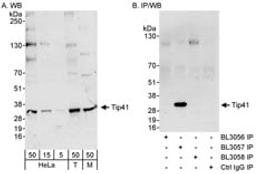 Detection of human and mouse Tip41 by western blot (h & m) and immunoprecipitation (h).