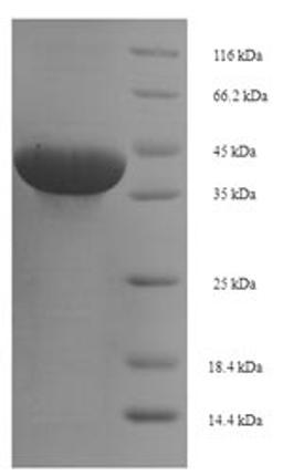 (Tris-Glycine gel) Discontinuous SDS-PAGE (reduced) with 5% enrichment gel and 15% separation gel.
