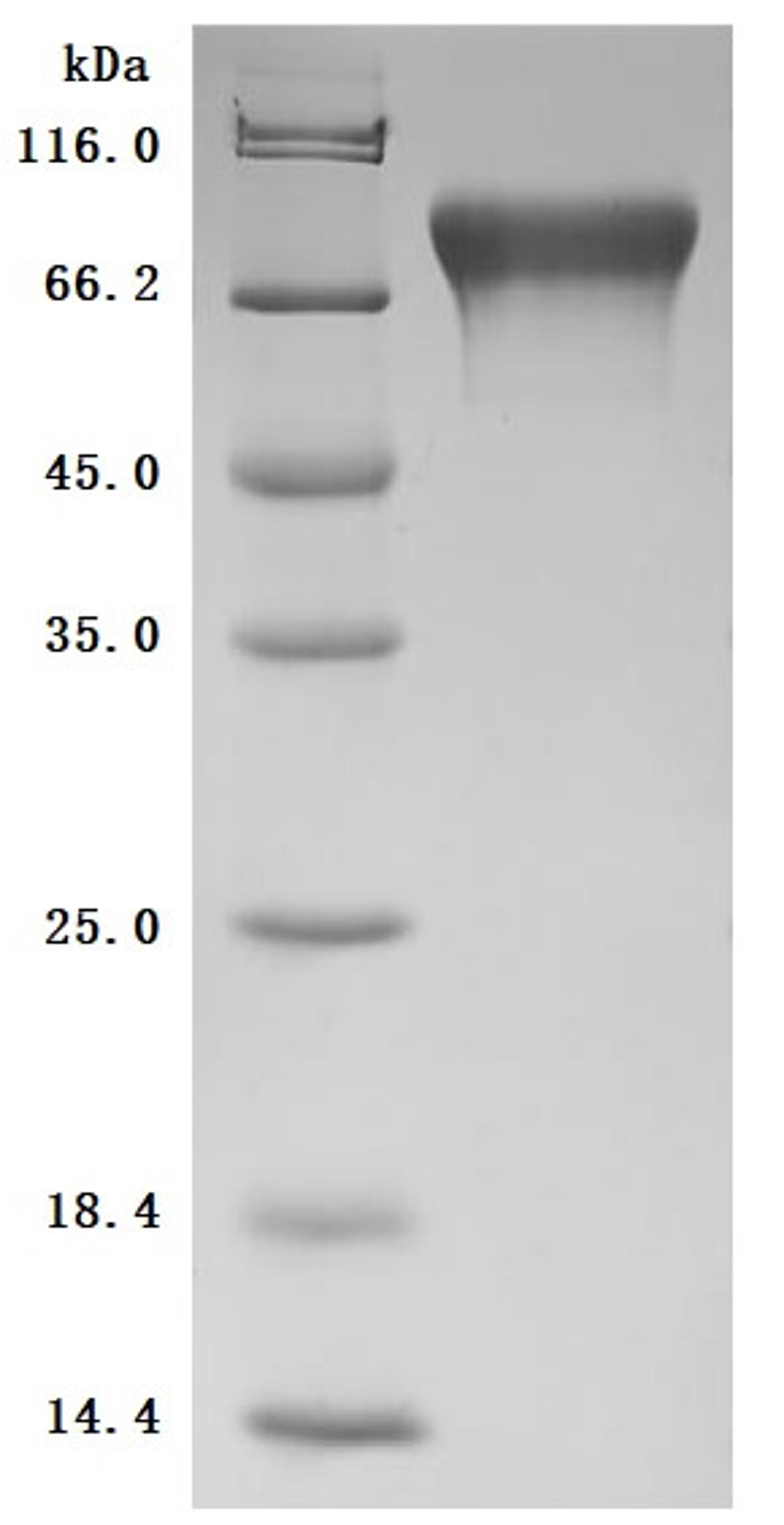 (Tris-Glycine gel) Discontinuous SDS-PAGE (reduced) with 5% enrichment gel and 15% separation gel.