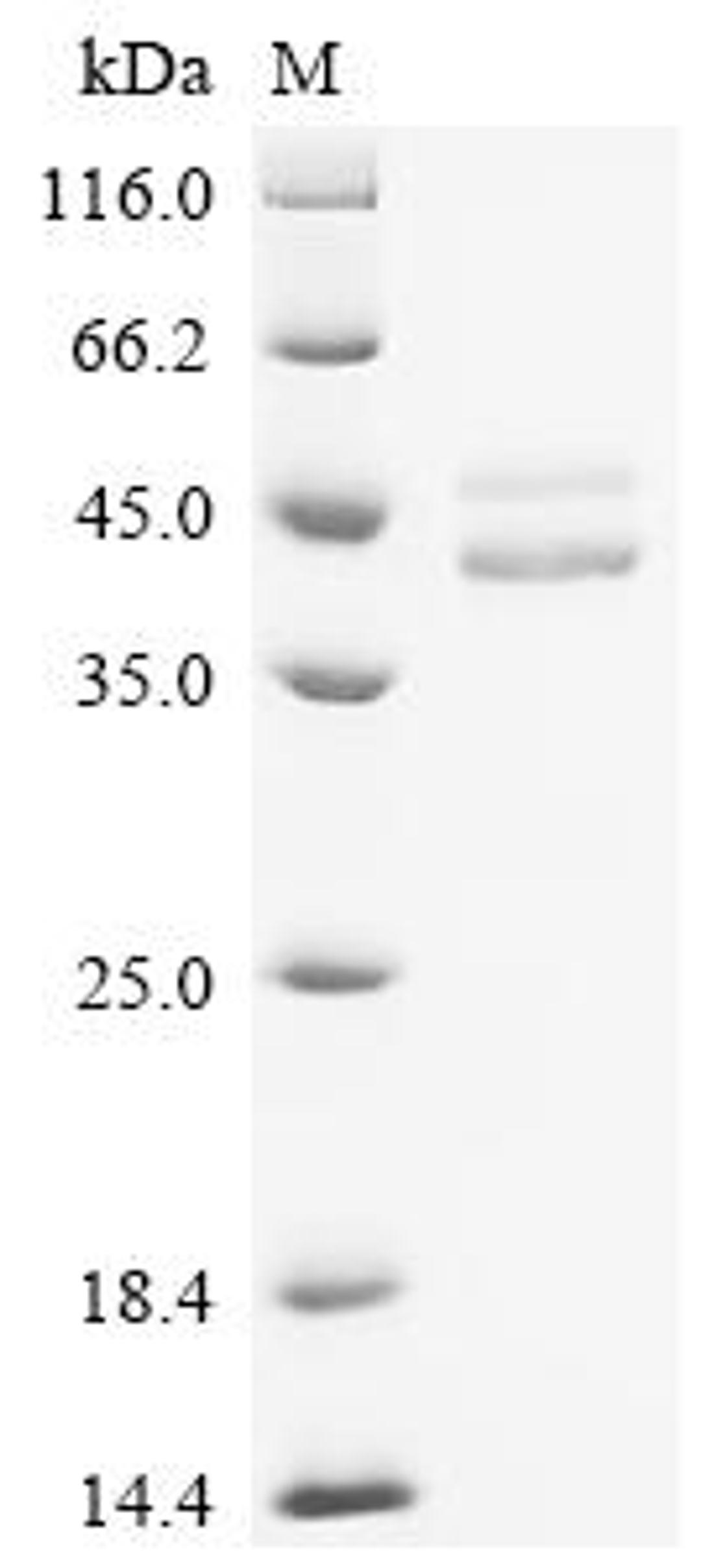 (Tris-Glycine gel) Discontinuous SDS-PAGE (reduced) with 5% enrichment gel and 15% separation gel.