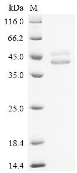 (Tris-Glycine gel) Discontinuous SDS-PAGE (reduced) with 5% enrichment gel and 15% separation gel.