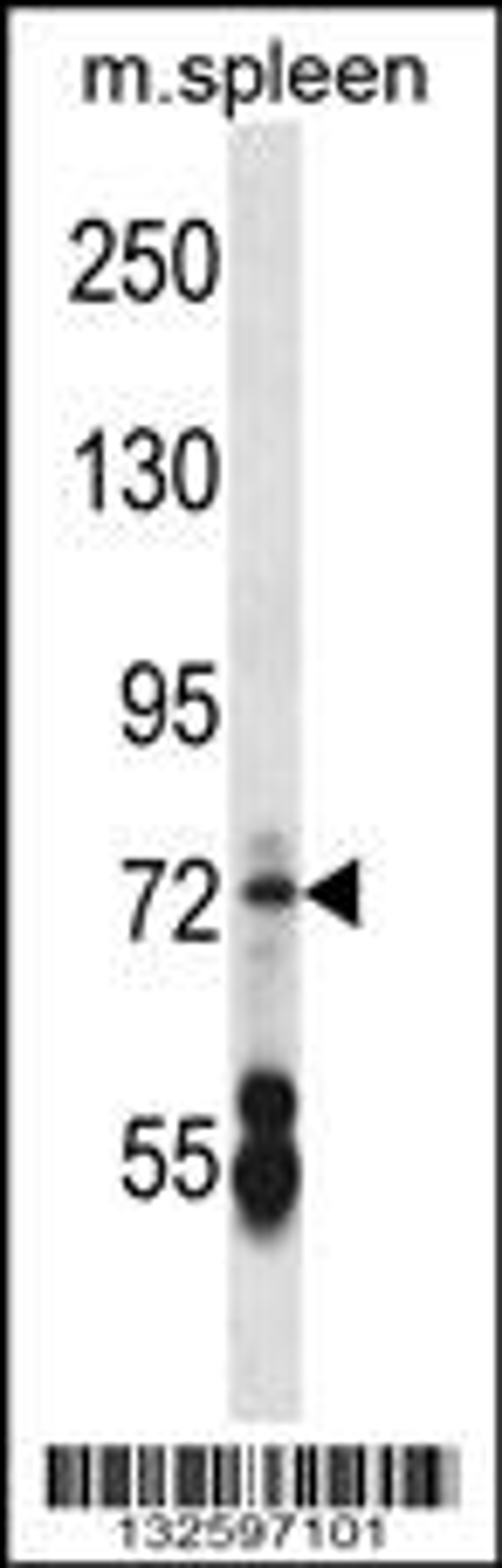 Western blot analysis in mouse spleen tissue lysates (35ug/lane).