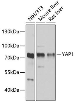 Western blot - YAP1 antibody (A11265)