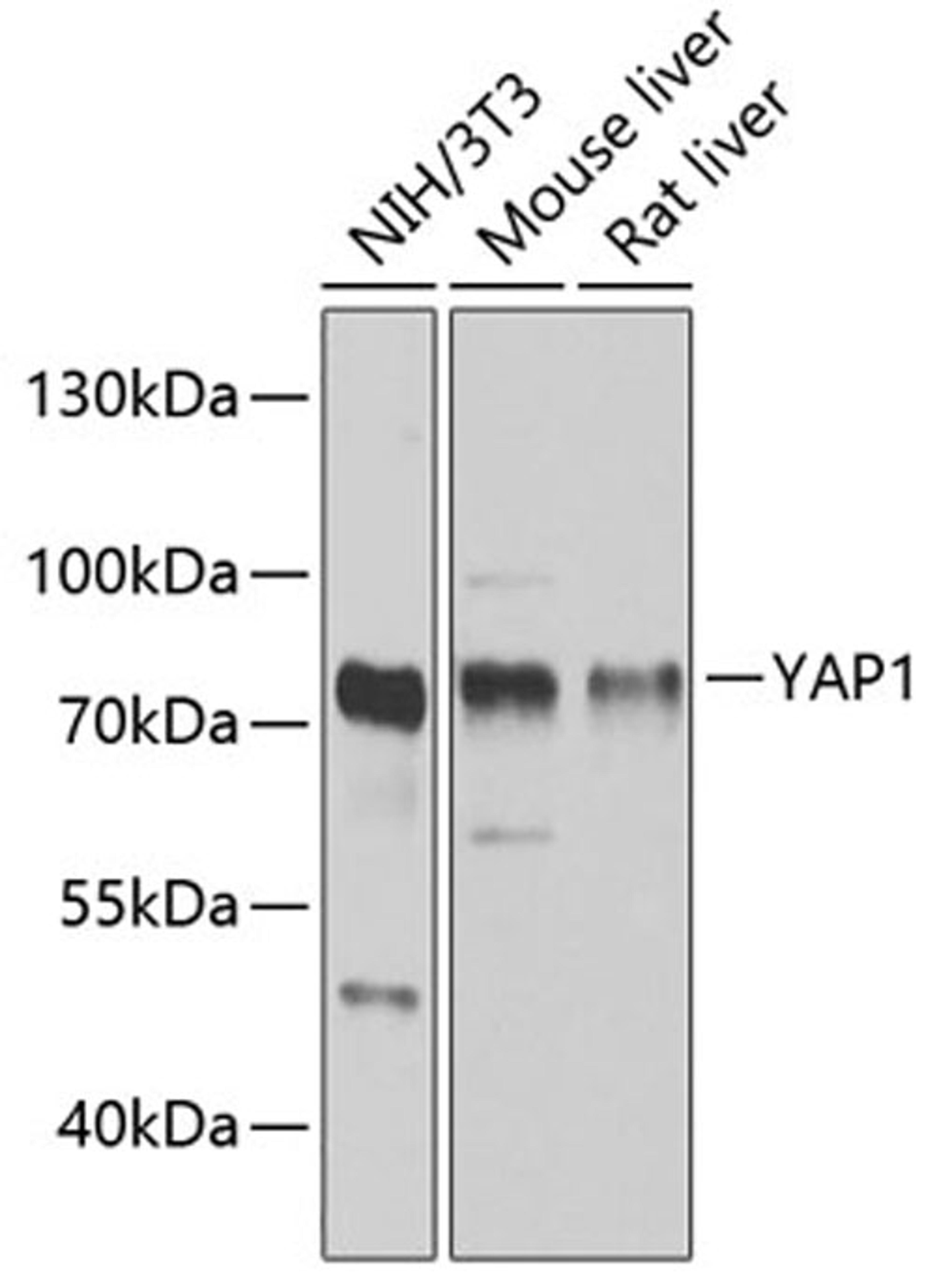 Western blot - YAP1 antibody (A11265)