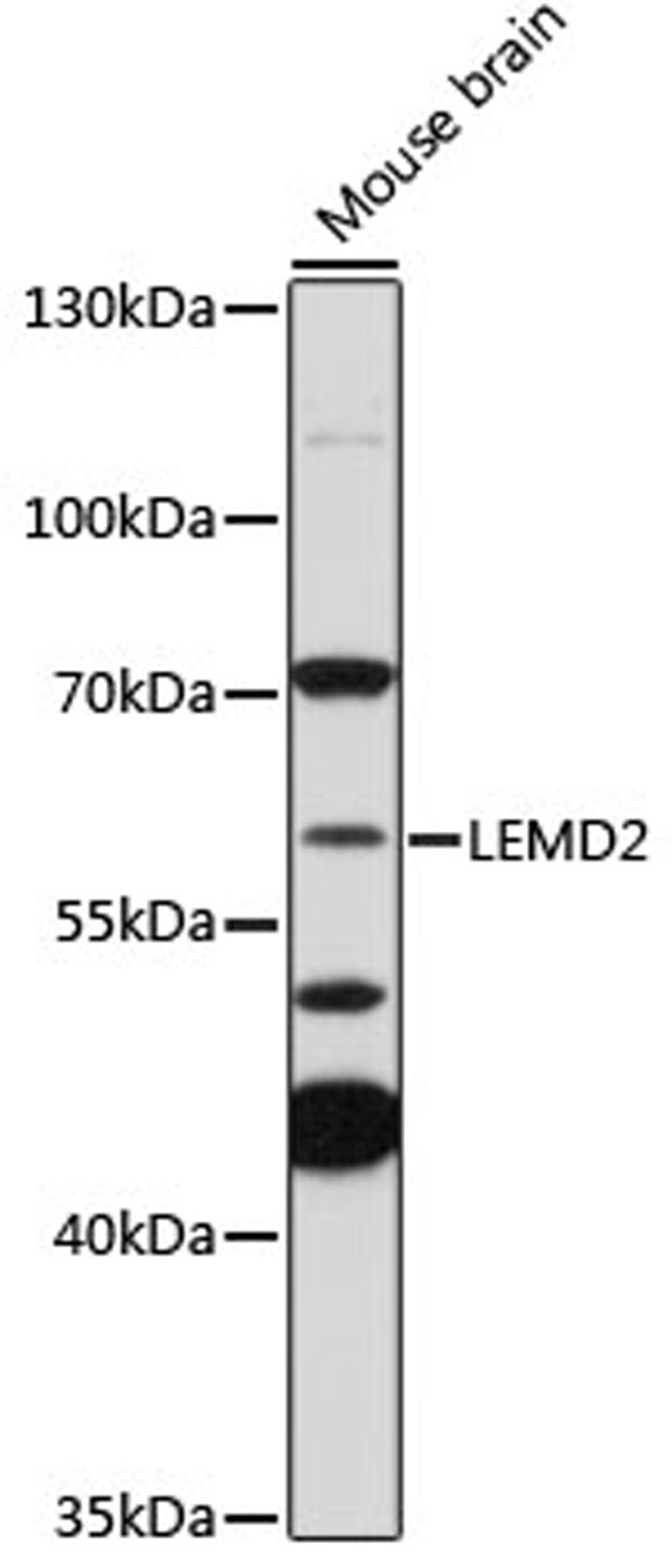 Western blot - LEMD2 Antibody (A18558)