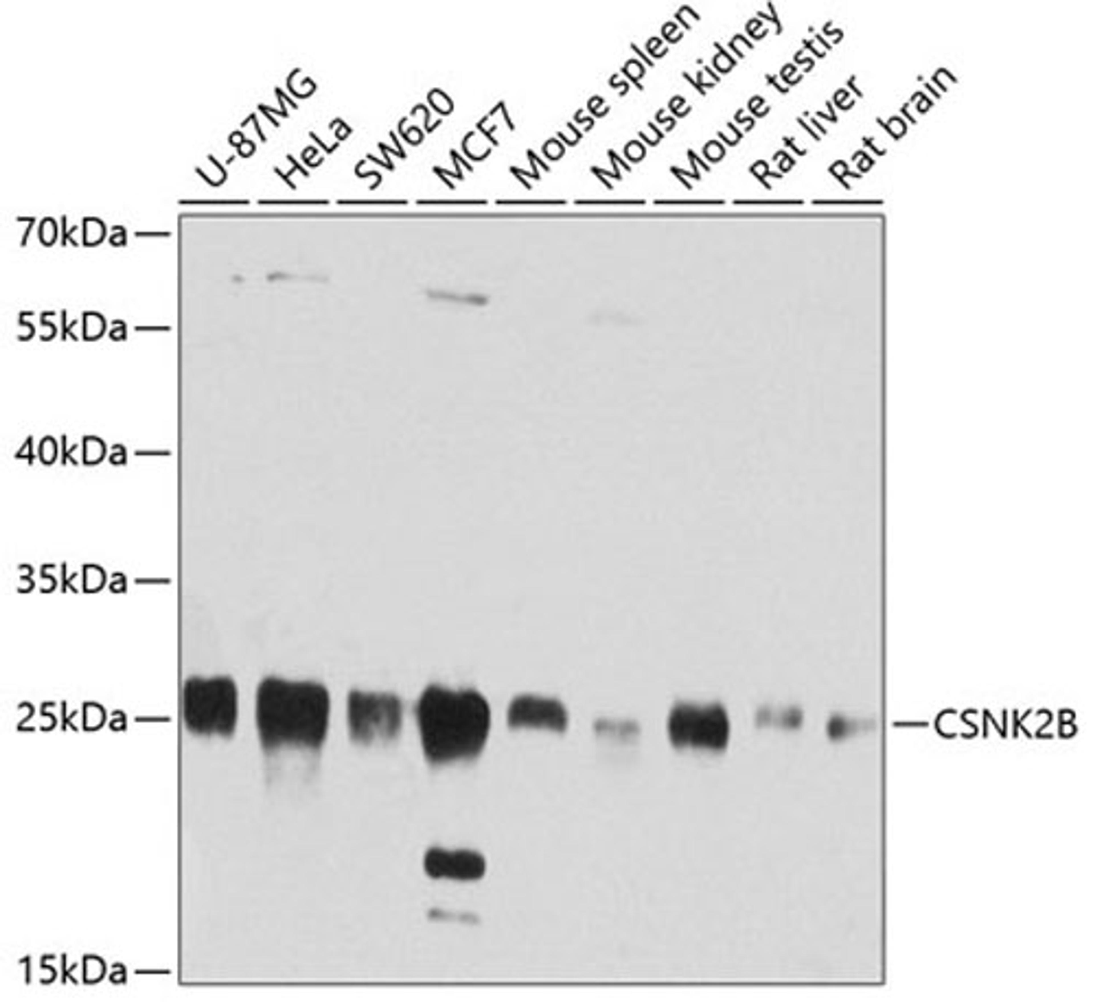 Western blot - CSNK2B antibody (A2869)