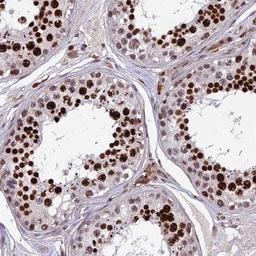 Immunohistochemistry-Paraffin: OTUD7A Antibody [NBP1-88434] - Staining of human testis shows strong nuclear positivity in cells in seminiferus ducts.