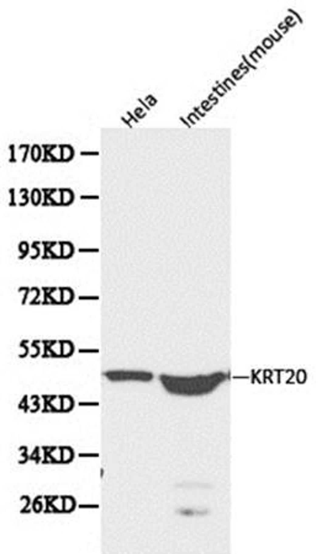 Western blot analysis of extracts from Hela cell line lysates using KRT20 antibody