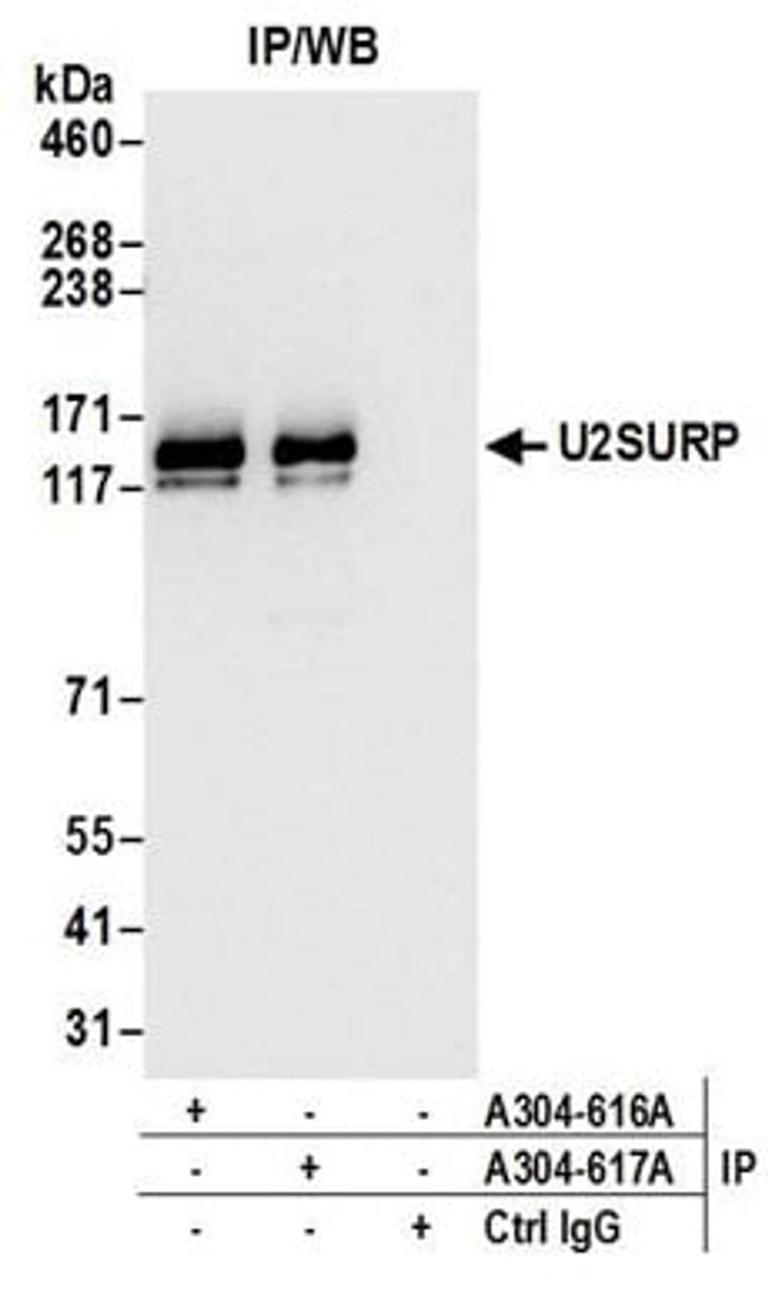 Detection of human U2SURP by western blot of immunoprecipitates.