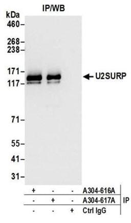 Detection of human U2SURP by western blot of immunoprecipitates.