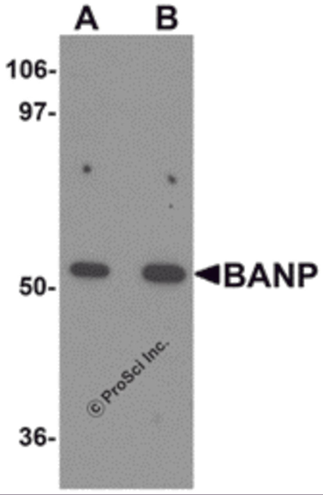 Western blot analysis of BANP in mouse kidney tissue lysate with BANP antibody at (A) 1 and (B) 2 &#956;g/mL.