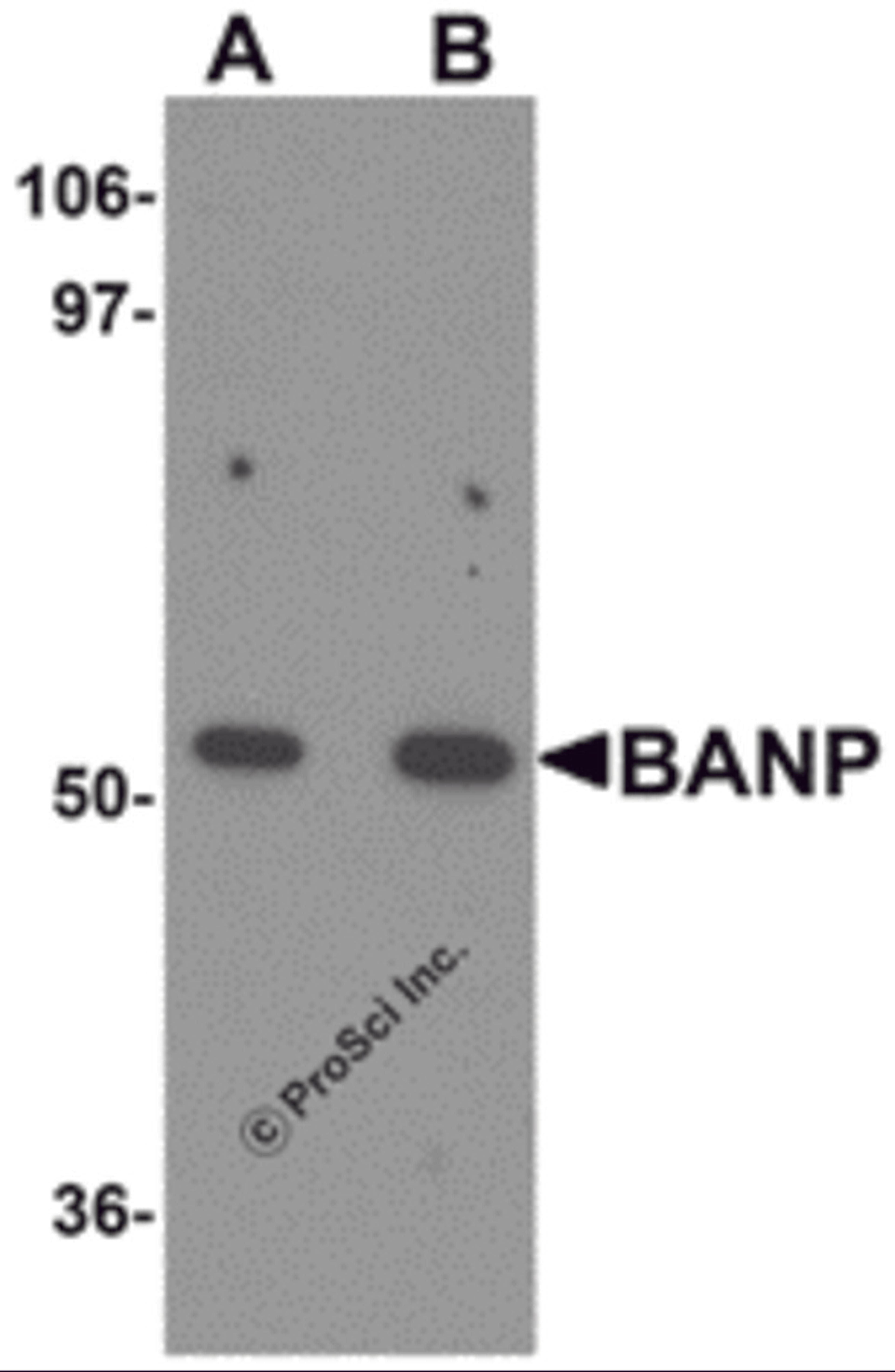 Western blot analysis of BANP in mouse kidney tissue lysate with BANP antibody at (A) 1 and (B) 2 μg/mL.