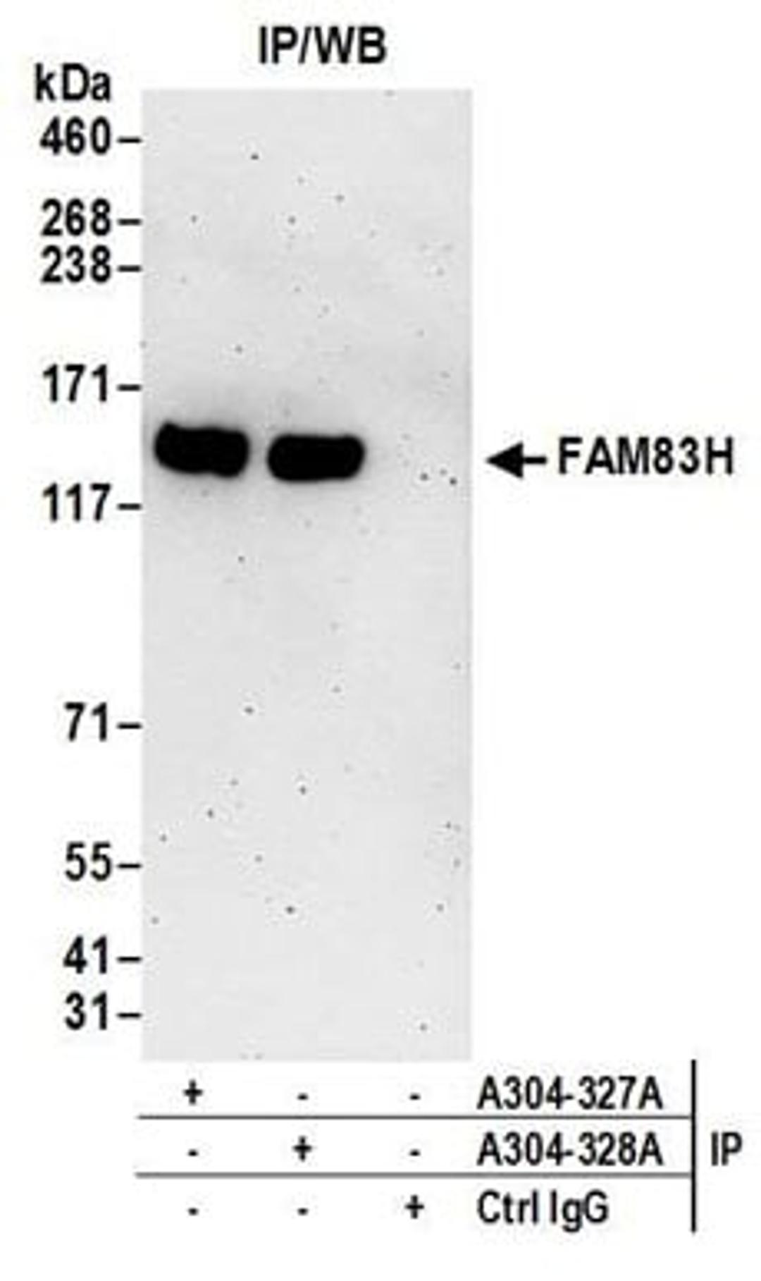 Detection of human FAM83H by western blot of immunoprecipitates.