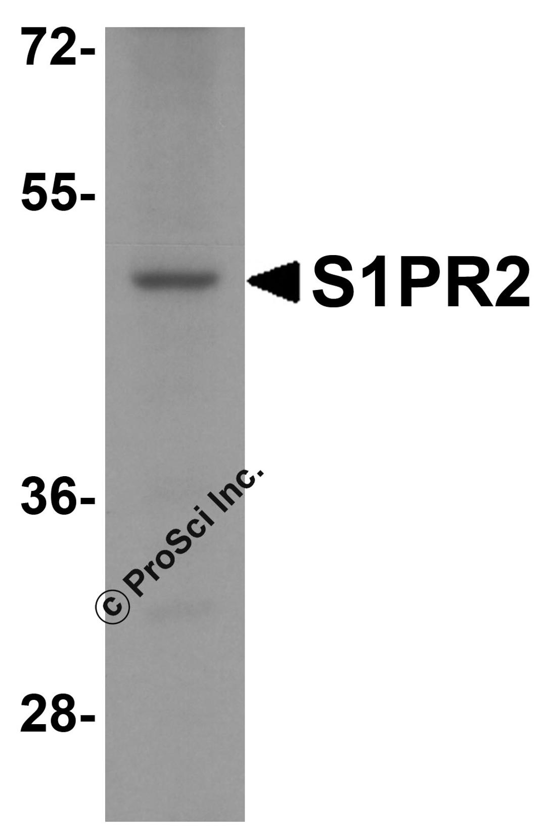 Western blot analysis of S1PR2 in HeLa cell lysate with S1PR2 antibody at 1 μg/ml.