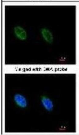 Immunocytochemistry/Immunofluorescence: ATR Antibody (2B5) [NB100-308] - Analysis of HeLa, using antibody at 1:100 dilution.