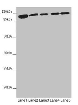 Western blot. All lanes: DHTKD1 antibody at 1.81µg/ml. Lane 1: Mouse liver tissue. Lane 2: Mouse kidney tissue. Lane 3: A431 whole cell lysate. Lane 4: MCF-7 whole cell lysate. Lane 5: HepG2 whole cell lysate. Secondary. Goat polyclonal to rabbit IgG at 1/10000 dilution. Predicted band size: 103 kDa. Observed band size: 103 kDa