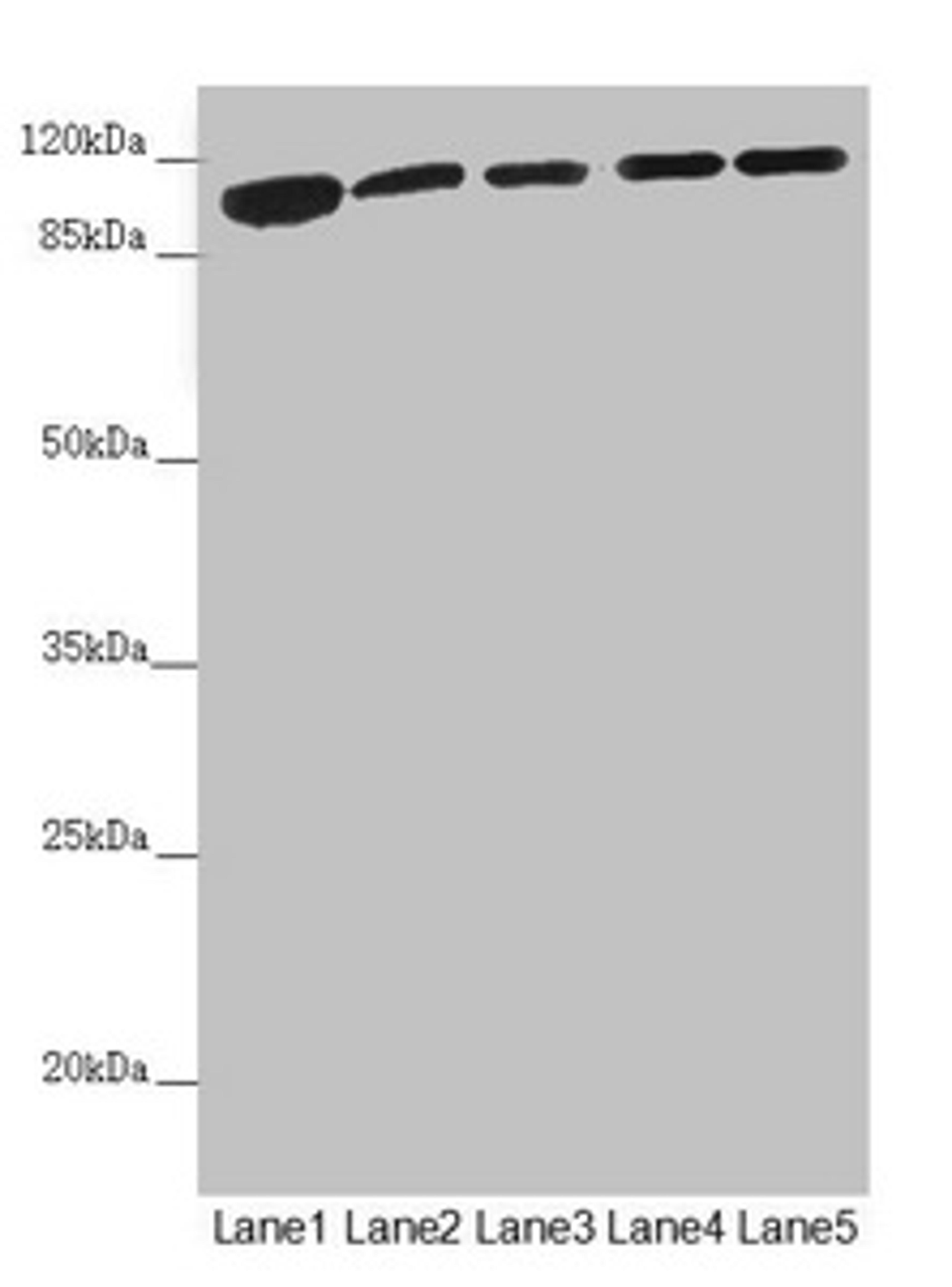 Western blot. All lanes: DHTKD1 antibody at 1.81µg/ml. Lane 1: Mouse liver tissue. Lane 2: Mouse kidney tissue. Lane 3: A431 whole cell lysate. Lane 4: MCF-7 whole cell lysate. Lane 5: HepG2 whole cell lysate. Secondary. Goat polyclonal to rabbit IgG at 1/10000 dilution. Predicted band size: 103 kDa. Observed band size: 103 kDa